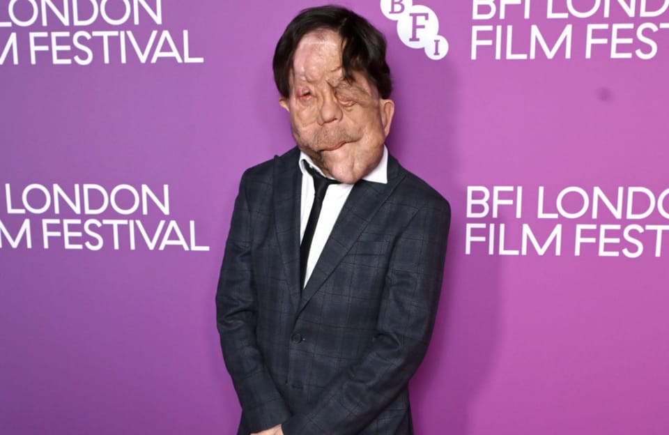 Adam Pearson praises positive disability representation progress in film industry