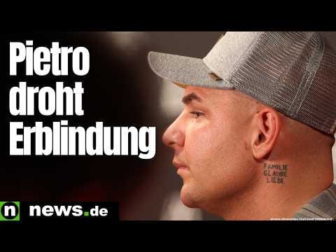 Pietro Lombardi in Sorge: Sänger hat 60 Prozent seiner Sehkraft verloren - ihm droht Erblindung